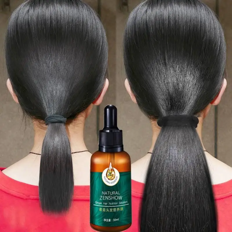Hair Care Herbal Products - Ingwer Haarwuchs ätherisches Öl Kräuter Haarpflege