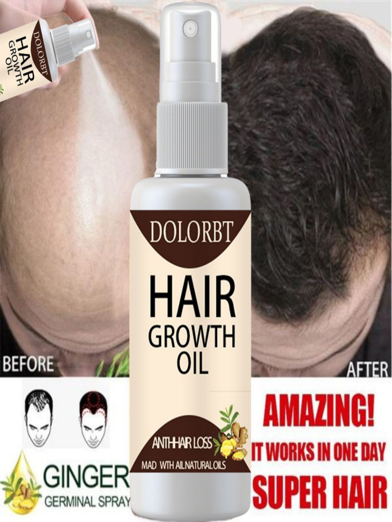 Hair Care Herbal Products - Haar Wachstum Essenz Öl Spray Pflanzliche