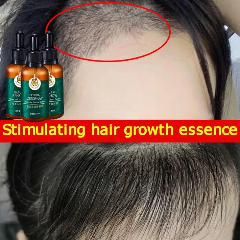 Ingwer Haarwuchs ätherisches Ö – Hair Care Herbal Products Bewertung und Preis