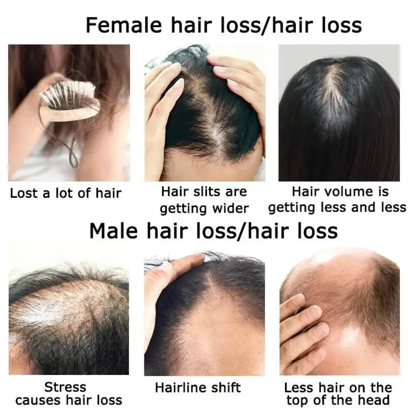 Ingwer Haarwuchs ätherisches Ö – Hair Care Herbal Products Bewertung und Preis