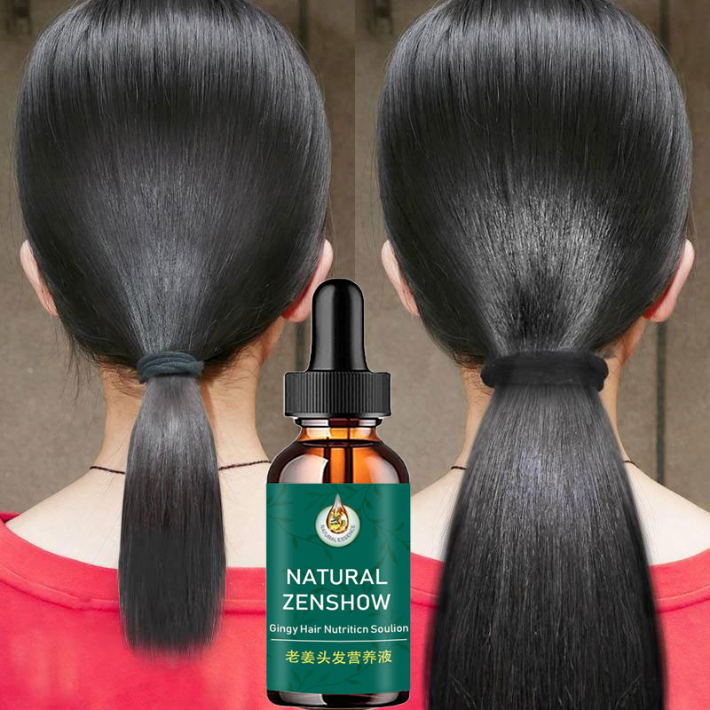 Ingwer Haarwuchs ätherisches Ö – Hair Care Herbal Products Bewertung und Preis