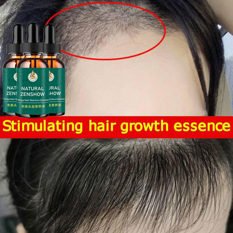 Ingwer Haarwuchs ätherisches Ö – Hair Care Herbal Products Bewertung und Preis