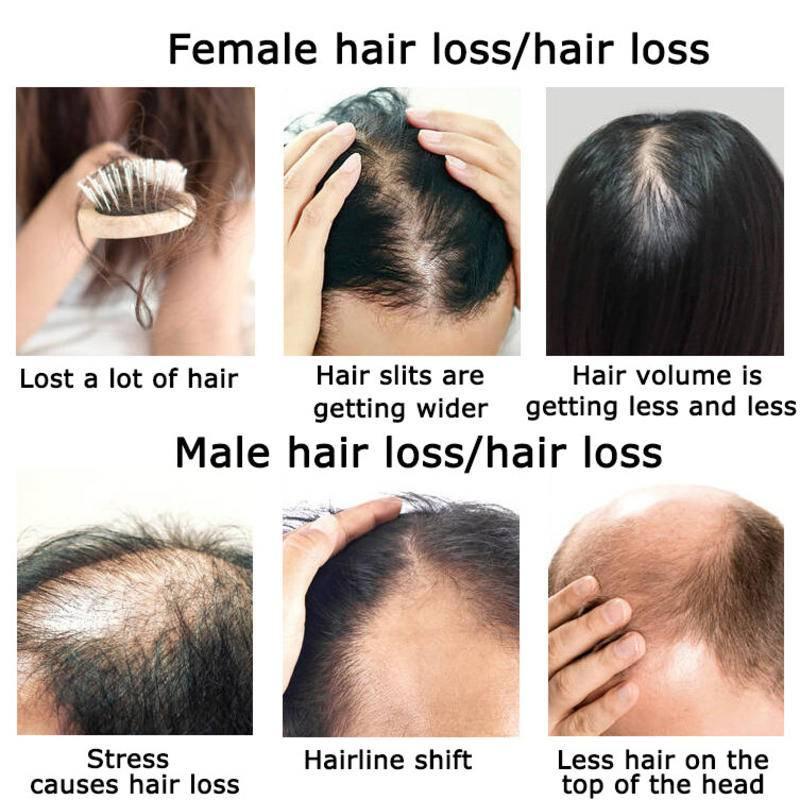 Ingwer Haarwuchs ätherisches Ö – Hair Care Herbal Products Bewertung und Preis