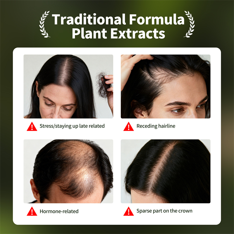 Natürliches Haarwachstumsset U – Hair Care Herbal Products Bewertung und Preis