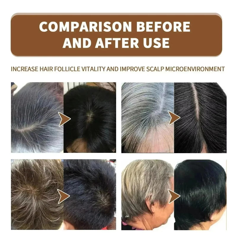 Kräuter-Anti-Grau-Behandlung H – Hair Care Herbal Products Bewertung und Preis