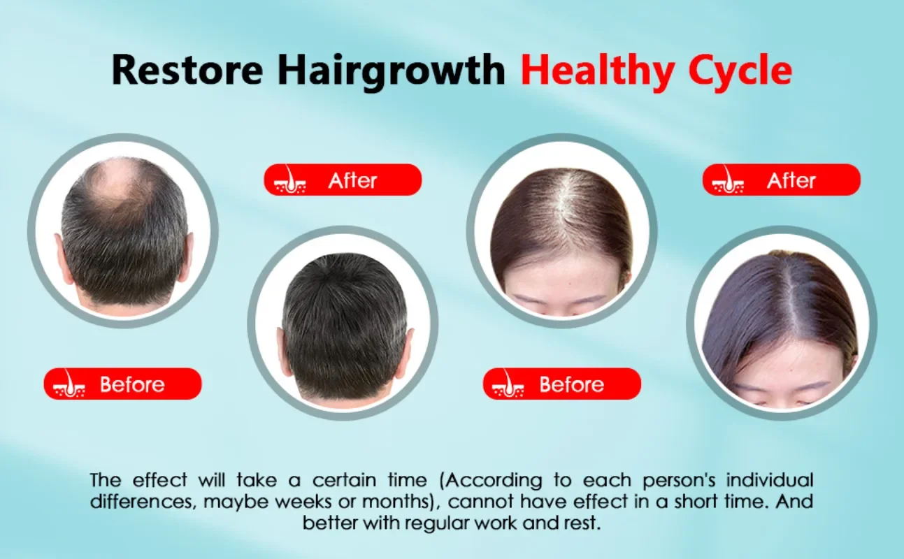 Haarwachstumskappe, wiederaufl – Hair Care Basic Bewertung und Preis