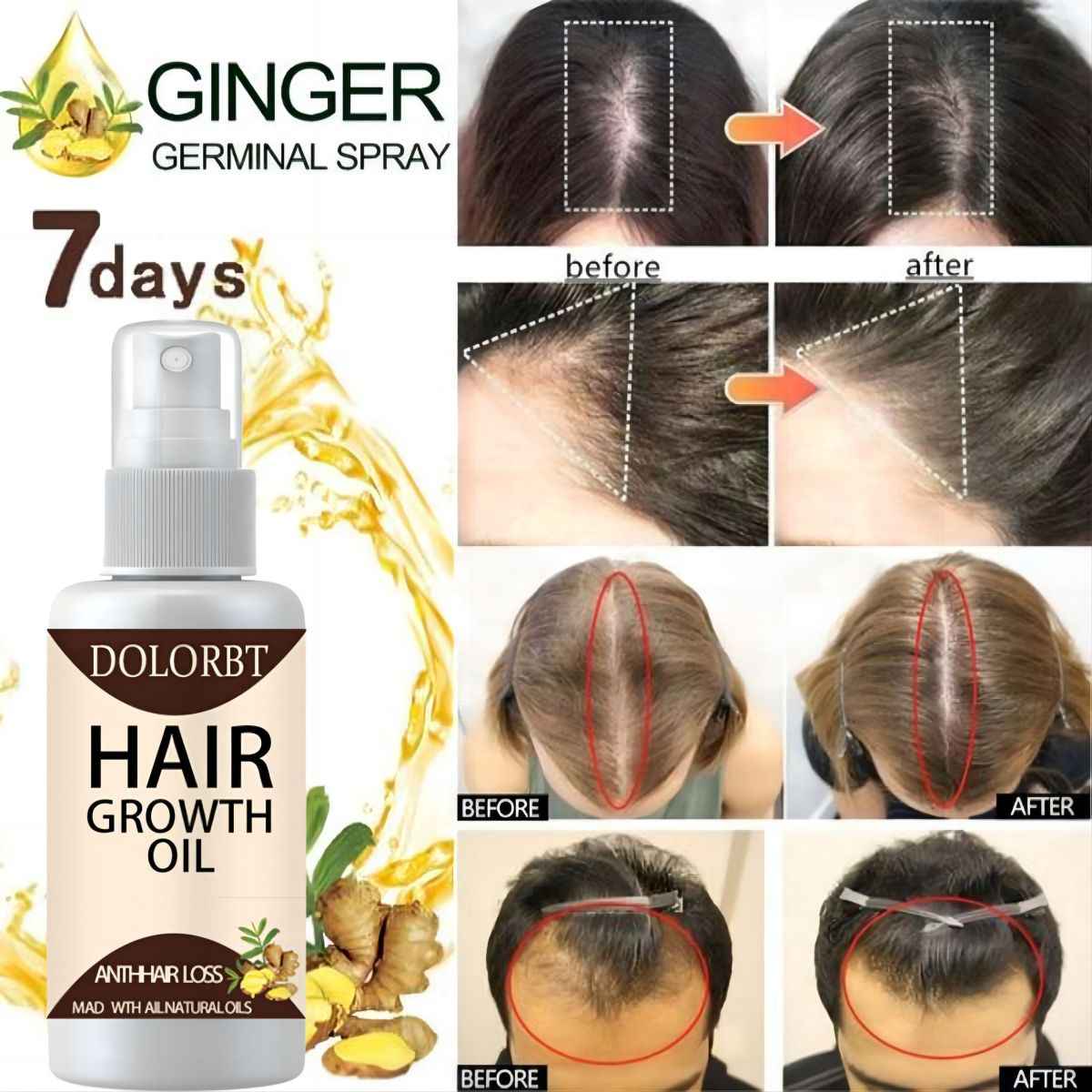 Haar Wachstum Essenz Öl Spray  – Hair Care Herbal Products Bewertung und Preis