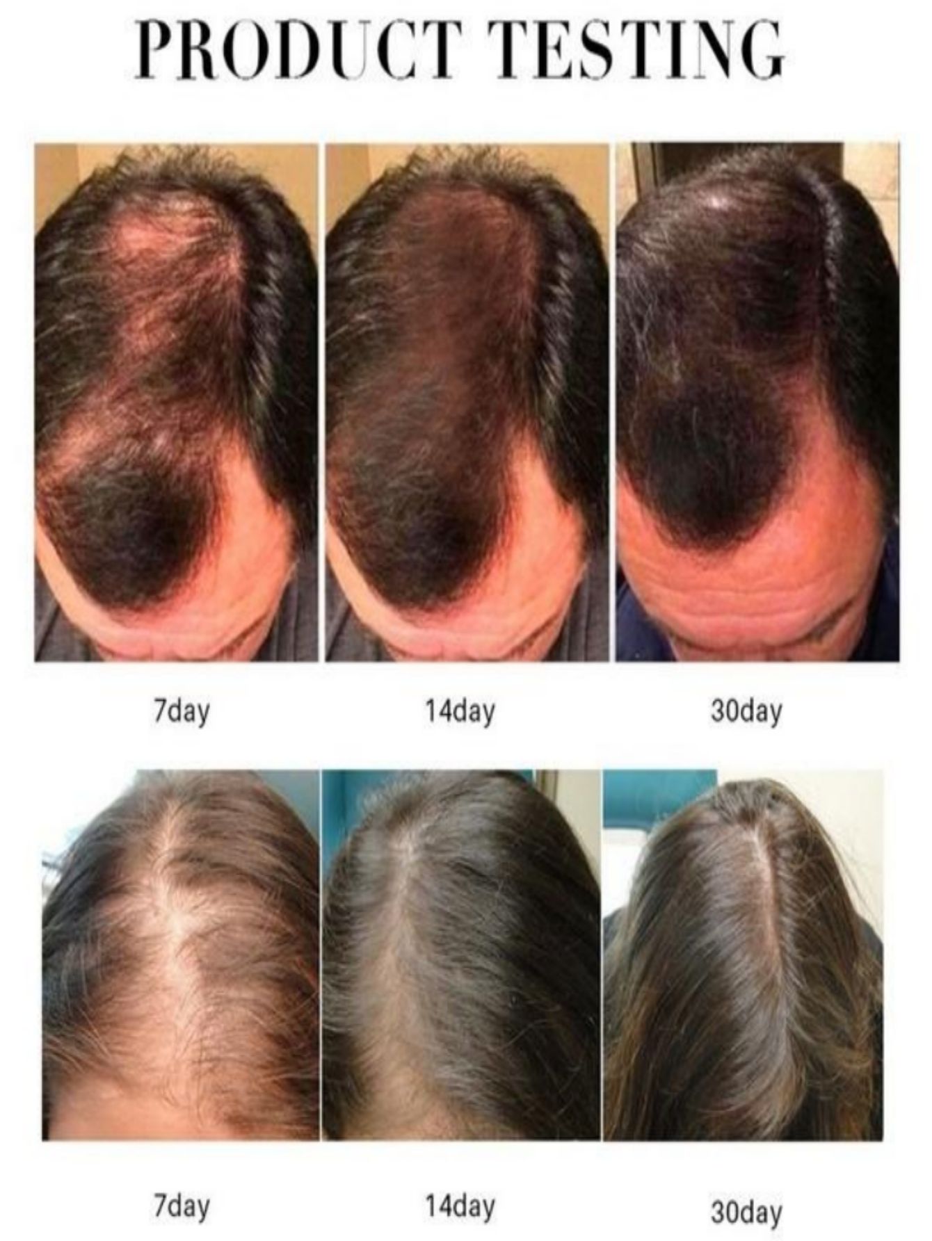 Haar Wachstum Essenz Öl Spray  – Hair Care Herbal Products Bewertung und Preis