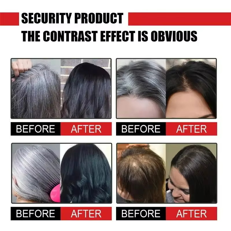 Kräuter-Anti-Grau-Haarbehandlu – Hair Care Herbal Products Bewertung und Preis