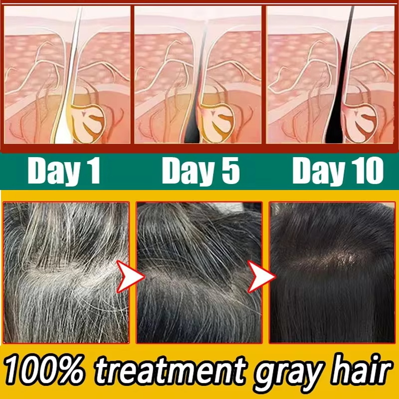 Kräuter-Anti-Grau-Haarbehandlu – Hair Care Herbal Products Bewertung und Preis