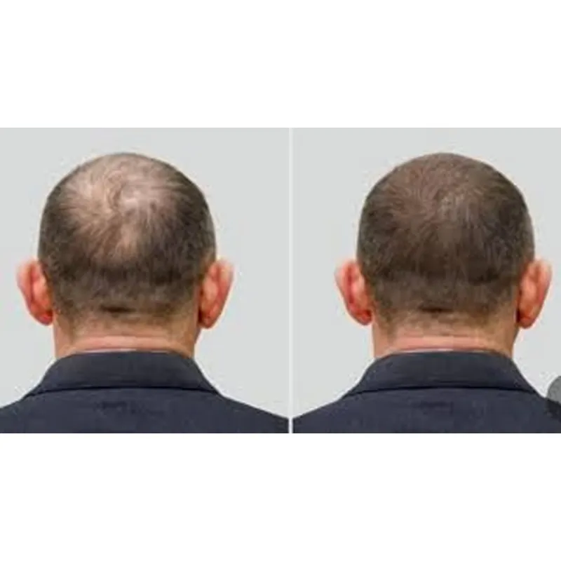 Hochwertiger Ozon-Hut für Kopf – Hair Care Good Hair Bewertung und Preis