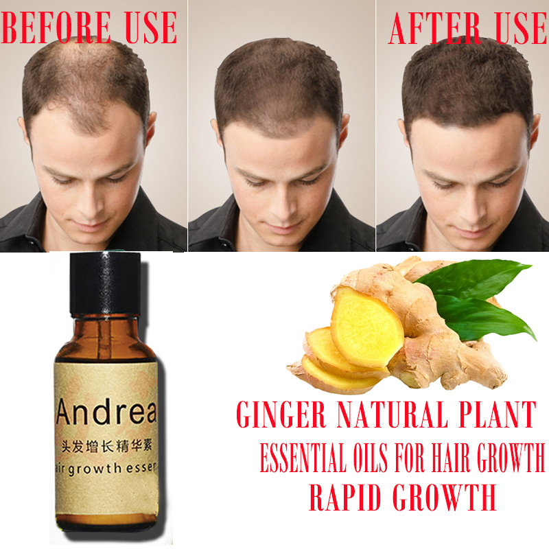 2/5/10Pcs Andrea Haar Wachstum – Hair Care Herbal Products Bewertung und Preis