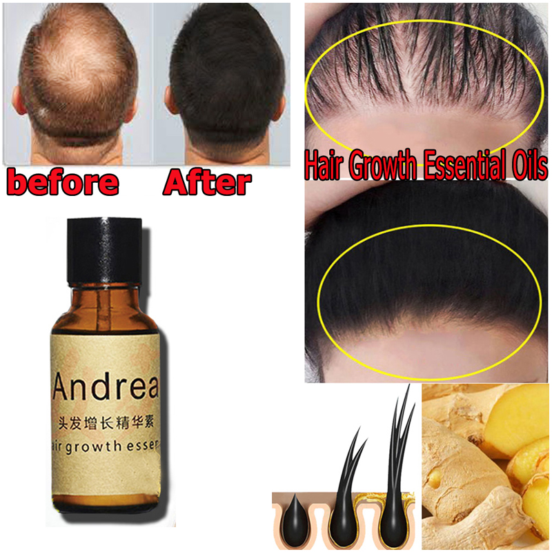 2/5/10Pcs Andrea Haar Wachstum – Hair Care Herbal Products Bewertung und Preis